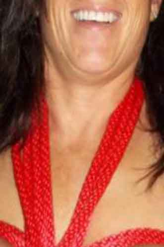 Anne, 45 år